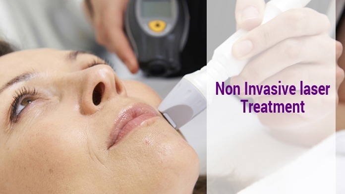 anti-aging symptoms, laser skin tightening, laser treatment, non-surgical lifting, non-surgical skin lift