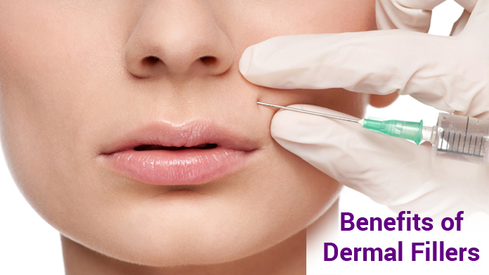 Best Fillers for Face, Cosmetic Fillers, Dermal Fillers, Face Fillers, Lip Fillers