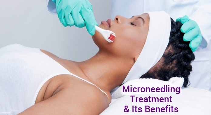 Microneedling treatment in india, Microneedling treatment cost in delhi, Microneedling treatment in rajouri garden