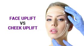 Cheek Enhancement Fillers, cheek uplift treatment in delhi, cheek uplift procedure, facelift procedure, remove fat from face, volume filler for face