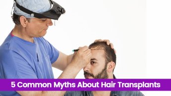 5 Common Myths About Hair Transplants - Look Young Clinic