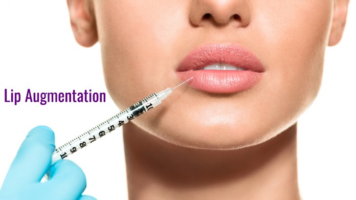 permanent lip fillers, lip fillers, lip filler cost, botox for lip fillers, lip enhancement treatment, Lip Fillers, lips filler treatment, lip uplift treatment, Botox lip injections in rajouri garden, Best dermal fillers in delhi, dermal fillers for lips