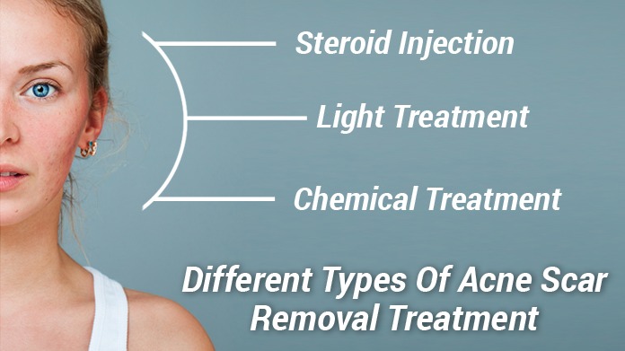 Acne Scar Removal Treatment in Delhi