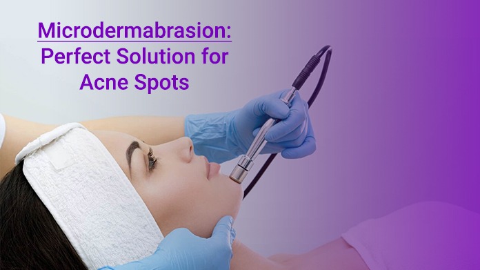 Microdermabrasion Clinic in Delhi