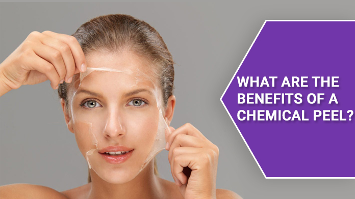 chemical peel treatment, chemical face peel, chemical skin peel, chemical peel for acne scars, smooth skin treatment, acne scar treatment