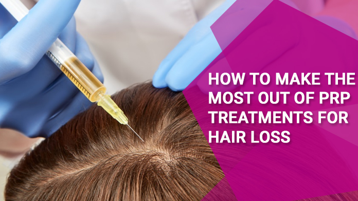 How To Make The Most Out Of PRP Treatments for Hair Loss