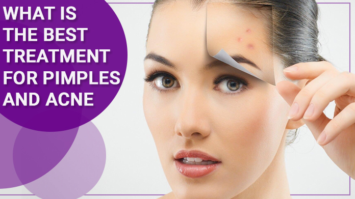 Acne Scar Treatment in Pitampura, Best acne treatment in west delhi, Best acne treatment in delhi, acne laser treatment cost in west delhi, acne scar removal treatment in delhi, Chemical peel cost, Micro needling treatment, Look Young Clinic Delhi