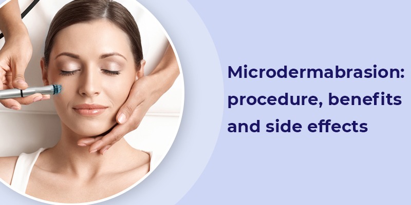 Microdermabrasion treatment