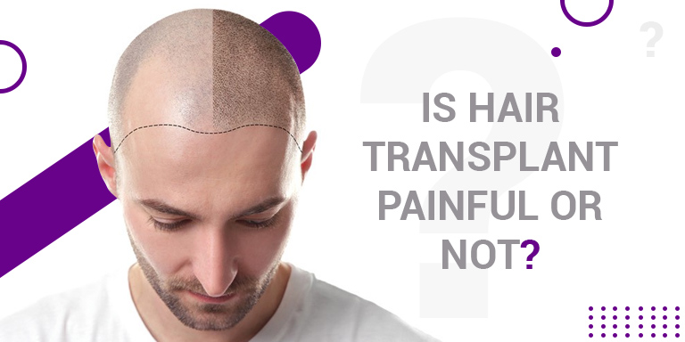 Is Hair Transplant Painful or Not? - Look Young Clinic