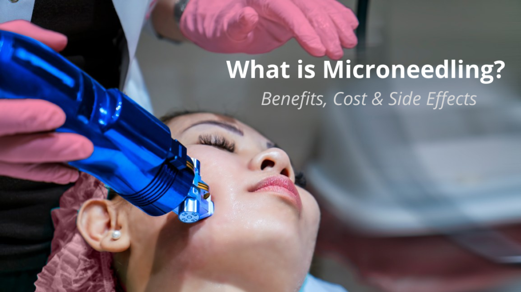 What is Microneedling