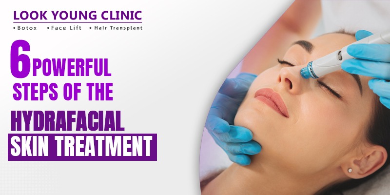 HydraFacial Skin Treatment