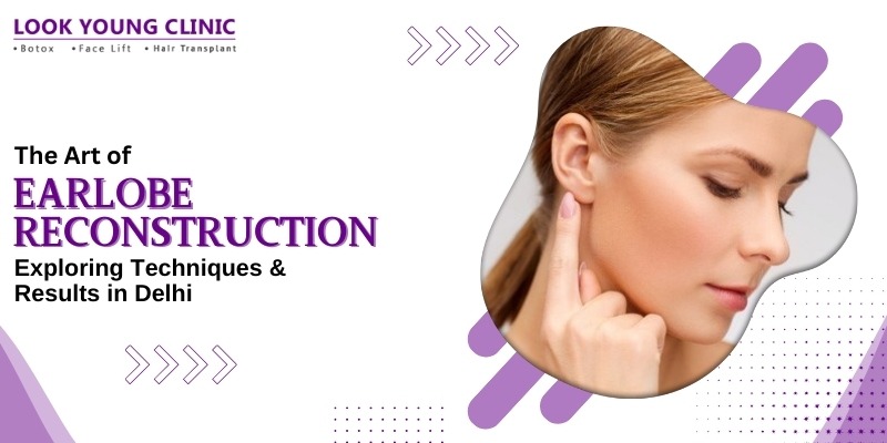 Earlobe Repair in Delhi