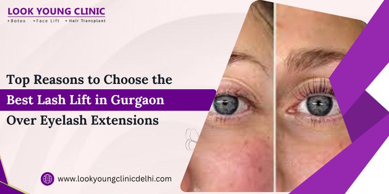 Top Reasons to Choose the Best Lash Lift in Gurgaon Over Eyelash Extensions