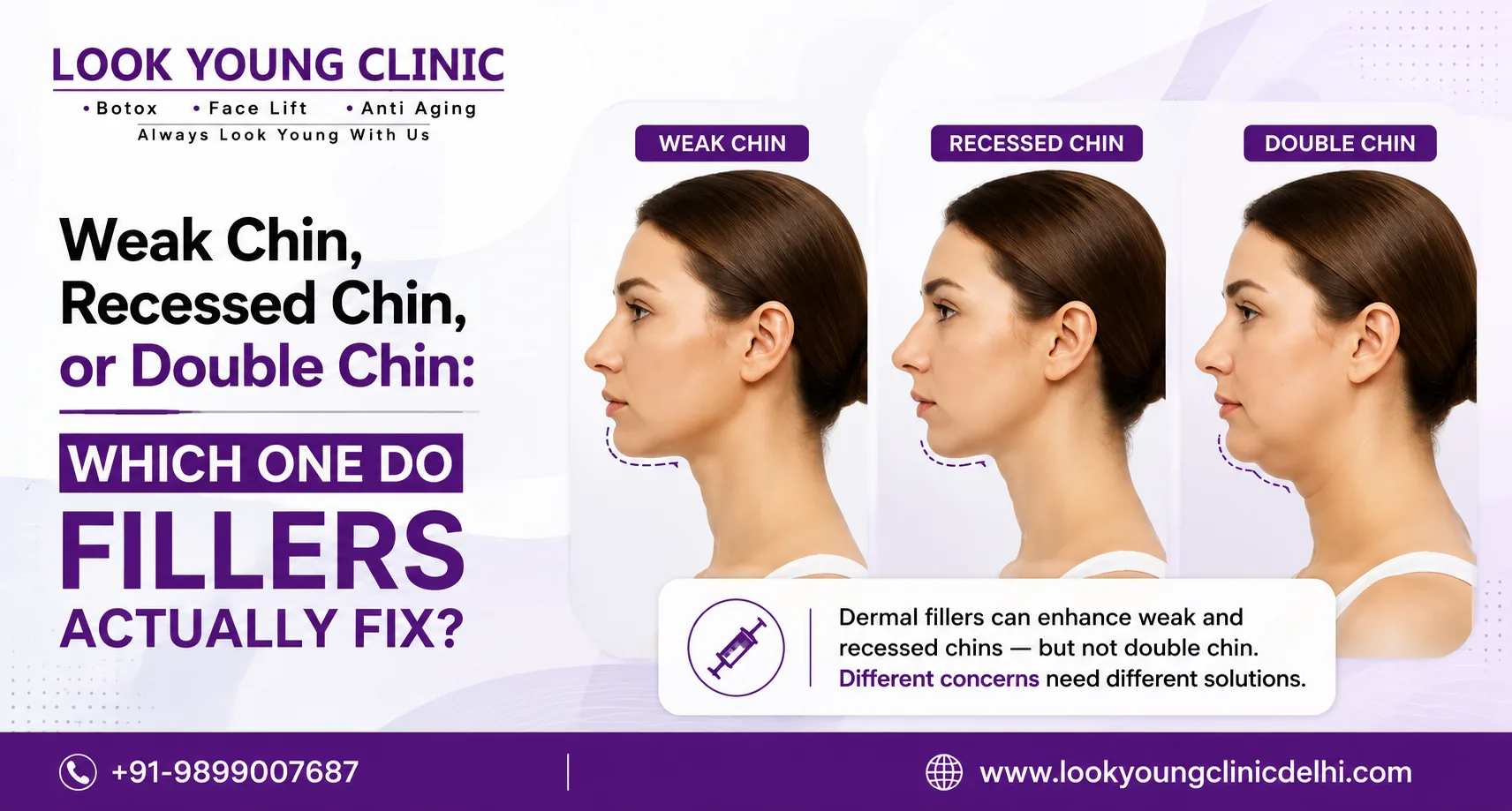 Weak Chin, Recessed Chin, or Double Chin: Which One Do Fillers Actually Fix?
