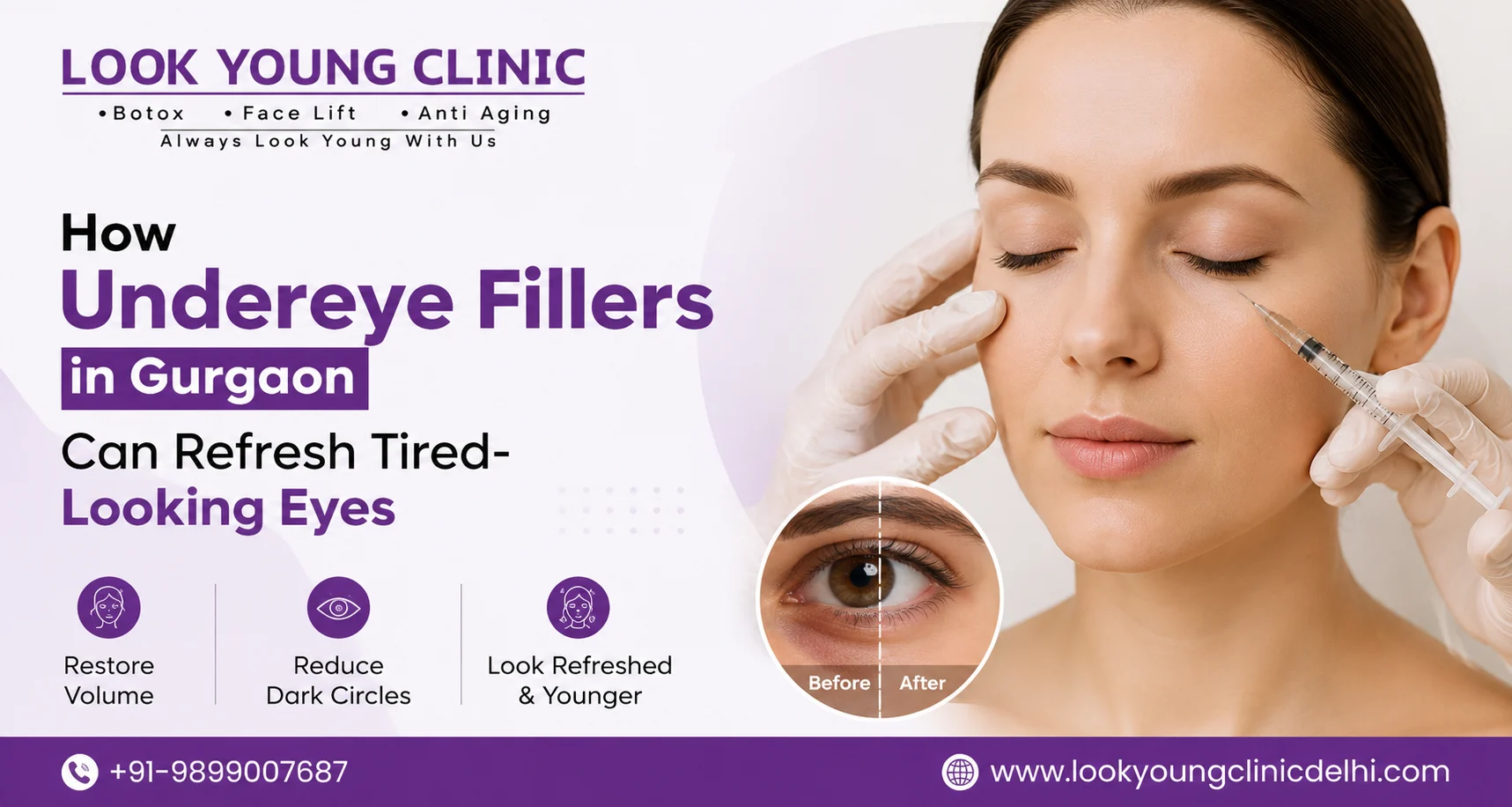 Undereye Fillers in Gurgaon: Cost, Benefits & What Really Happens During Treatment