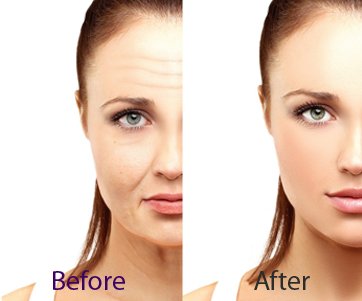 anti ageing clinic