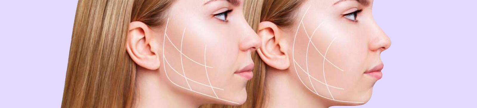 buccal fat reduction surgery clinic in delhi
