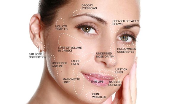 dermal fillers treatment in delhi, dermal fillers treatment in delhi, dermal fillers treatment, dermal fillers, dermal fillers before and after, dermal fillers side effects, dermal fillers in north delhi