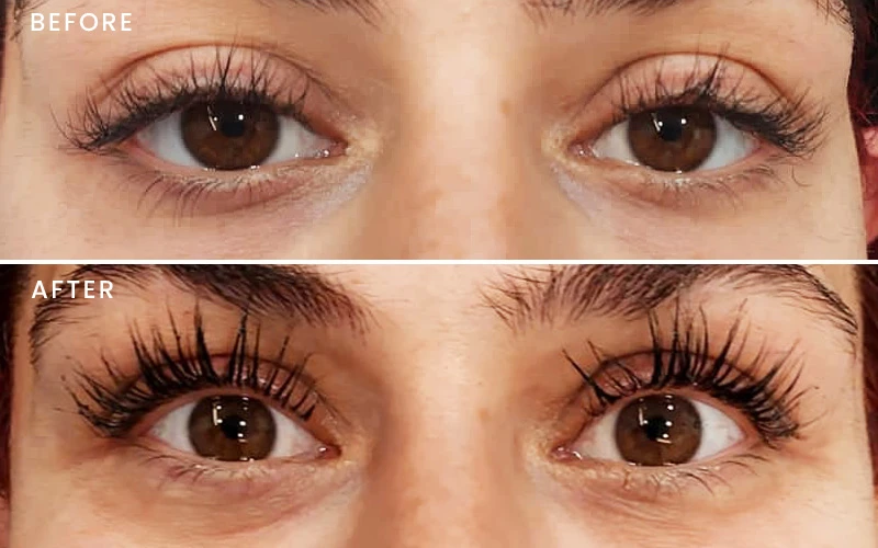 Skin treatment before after