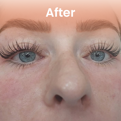 https://www.lookyoungclinicdelhi.com/New/wp-content/uploads/2025/03/lash-lifting-before.webp After lash lifting