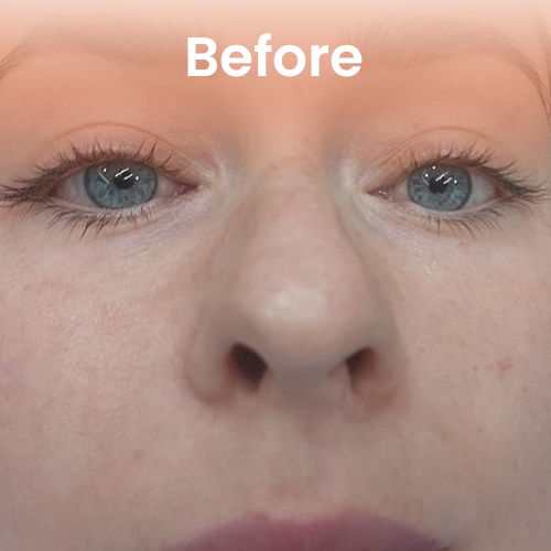 Before lash lifting