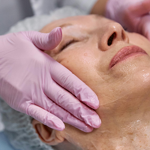 Dermal fillers for volume loss