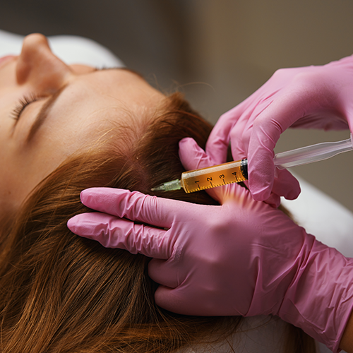 Before and after PRP therapy – effective hair regrowth and reduced thinning