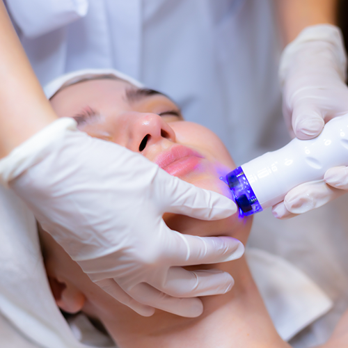 Before and after MNRF therapy – refined skin tone and reduced imperfections