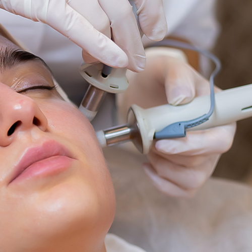 icroneedling RF before and after – smoother skin and reduced pores