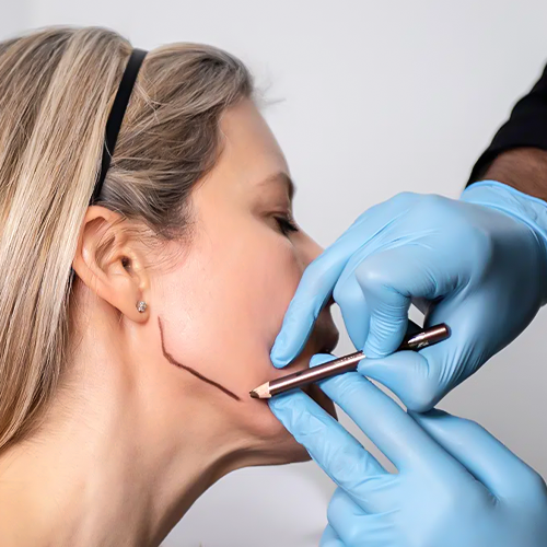 non-surgical lifting solutions