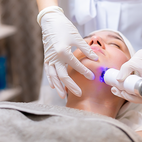 Microneedling radiofrequency session – non-invasive skin resurfacing solution