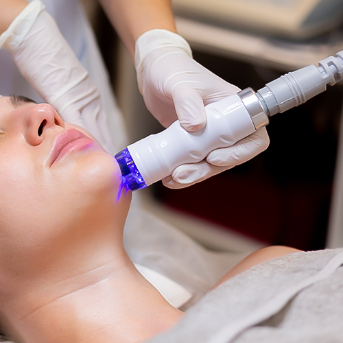 Radiofrequency microneedling for skin rejuvenation – clearer and firmer complexion