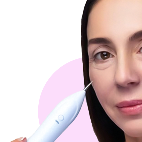 Plasma Pen skin tightening