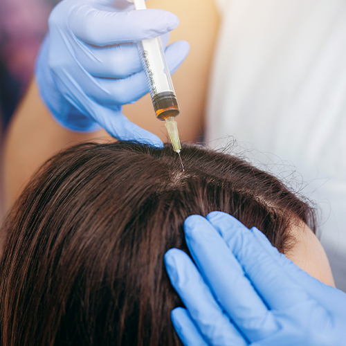 Skin rejuvenation with PRP – collagen boost and anti-aging results