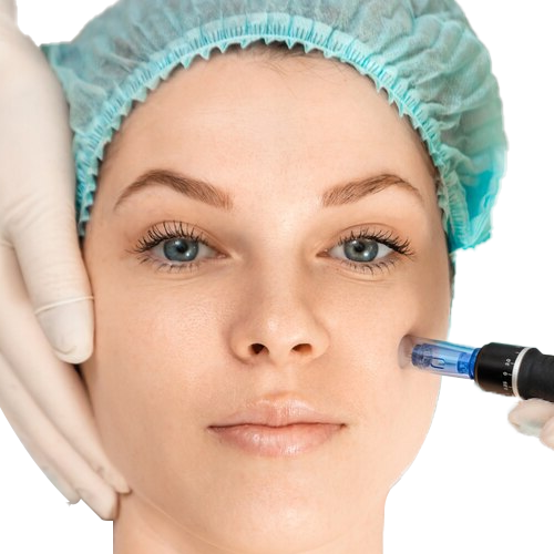 Cool Jet Plasma Treatment