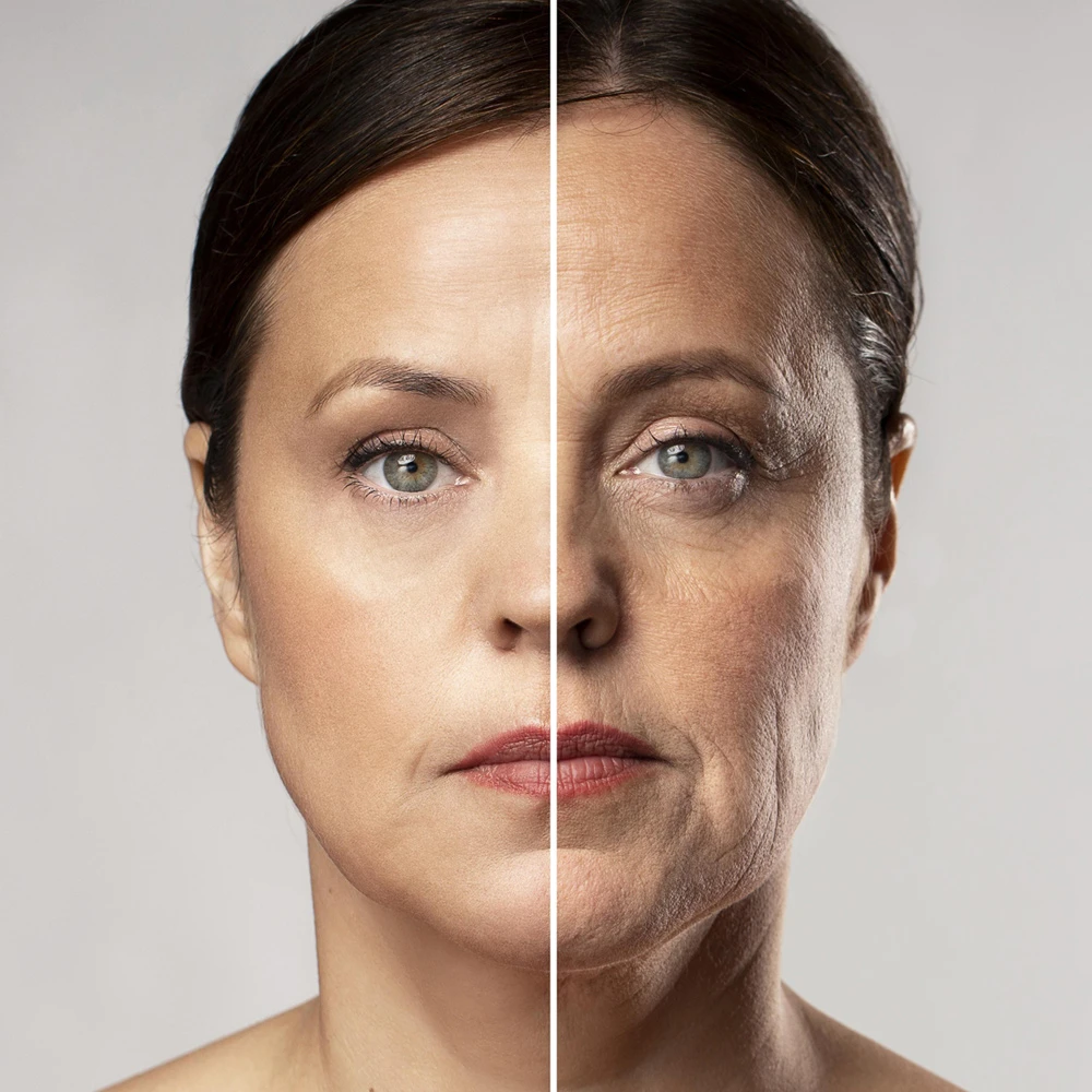 sagging skin treatment
