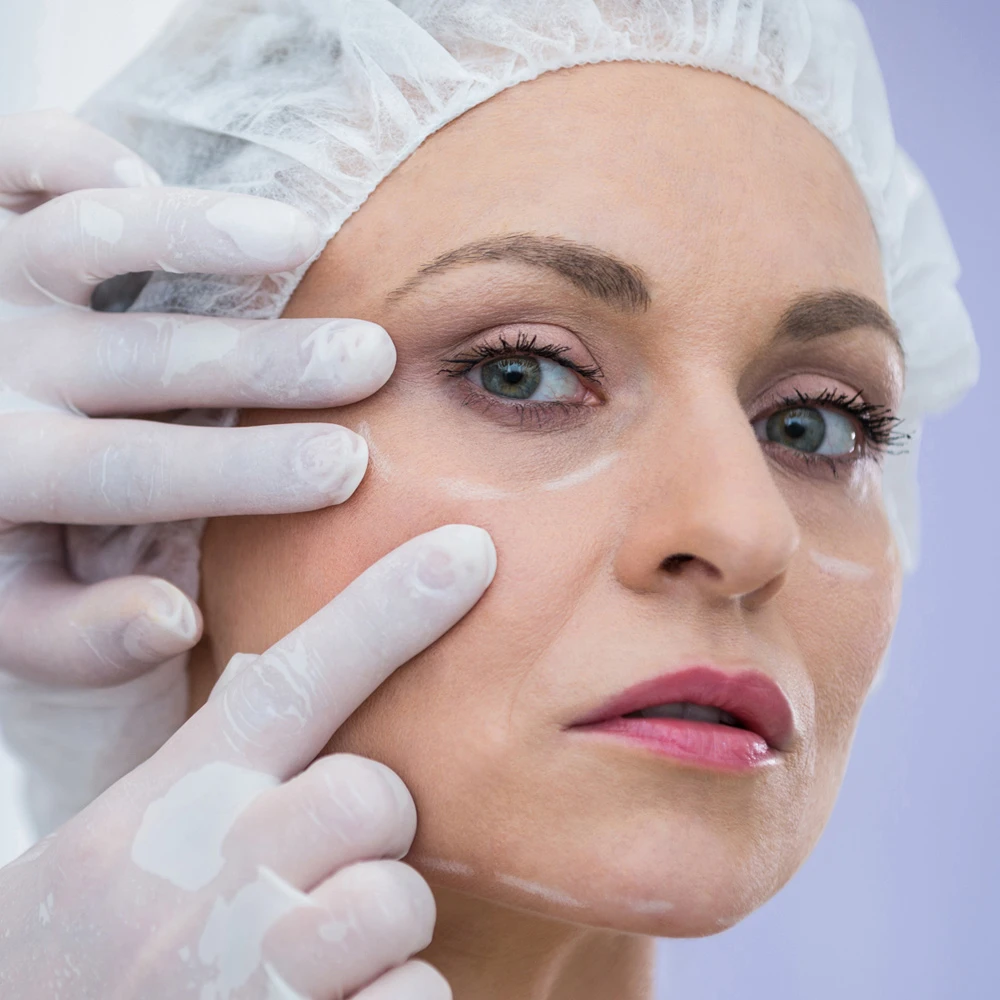 Non-Surgical Skin Lift