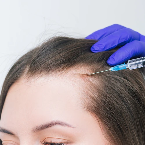 PRP Treatment