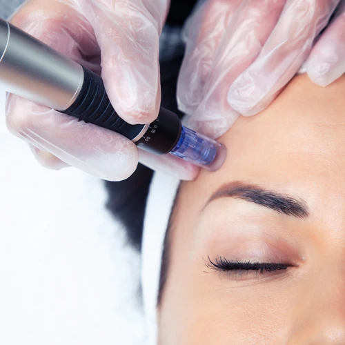 10_Microneedling Therapy_1_500X500
