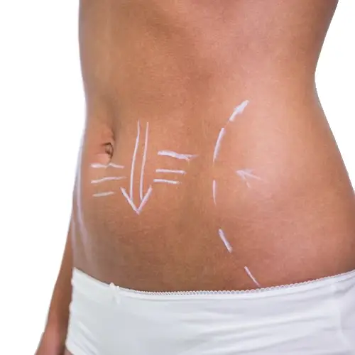 19_Hifu Body_1_500X500-1