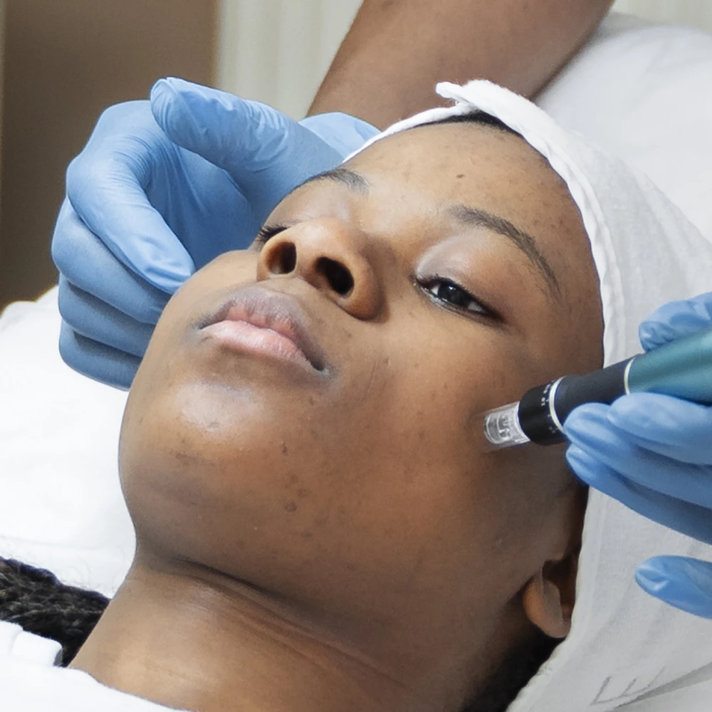 Dark Skin Treatments in Delhi