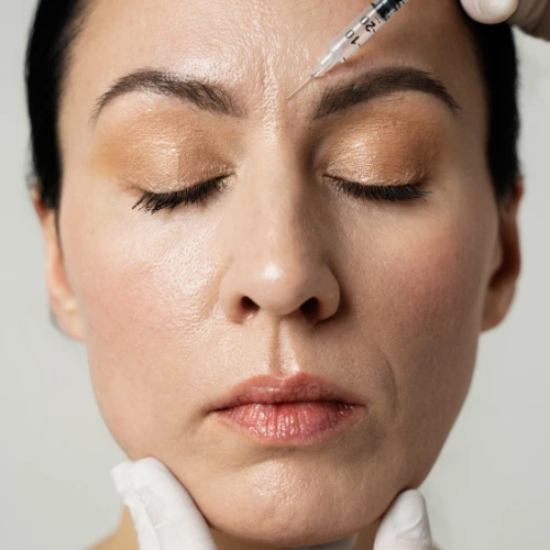 Vampire Facial PRP treatment in Delhi