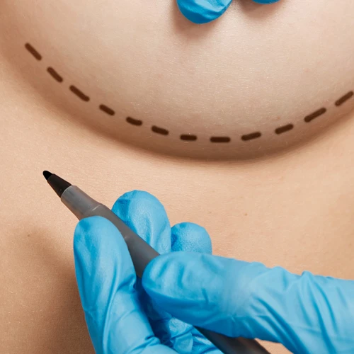 Prepare for a Filler Treatment