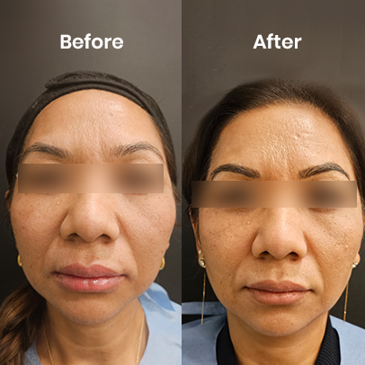 Microblading fully healed results 1