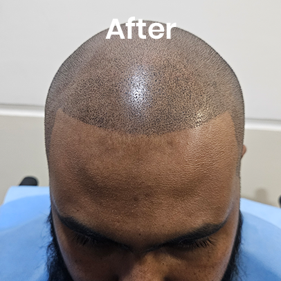 SMP after results Delhi